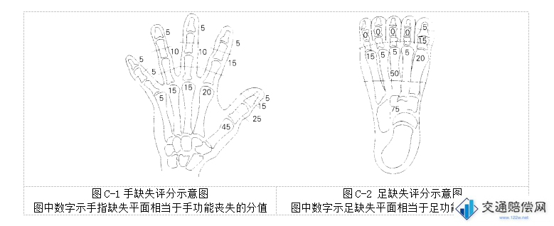 手、足缺失评分（见图C-1和图C-2）